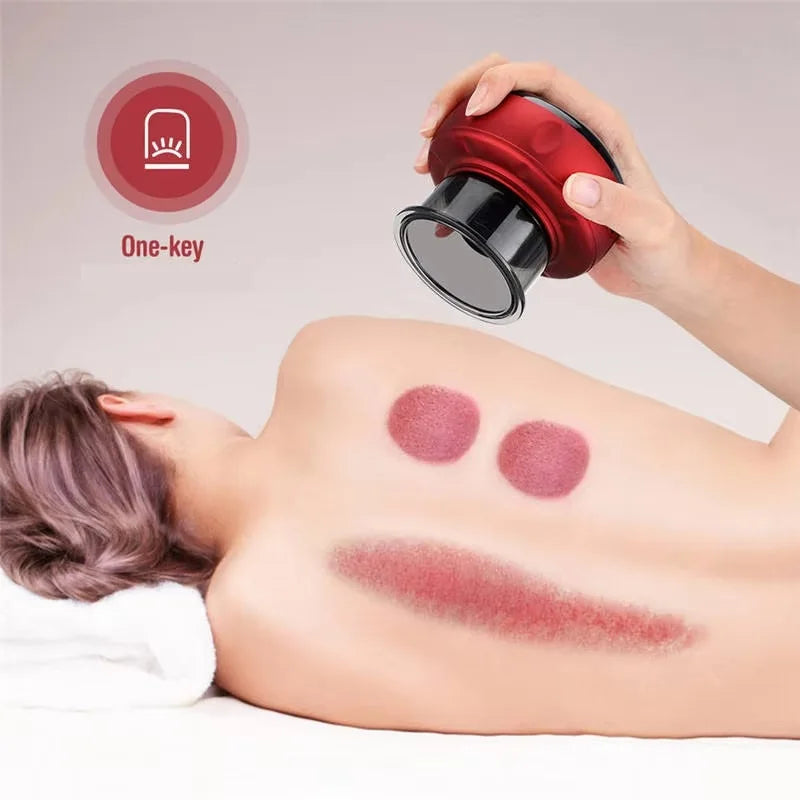 Hand holding red electric cupping therapy device on back with visible cupping marks, Motyx